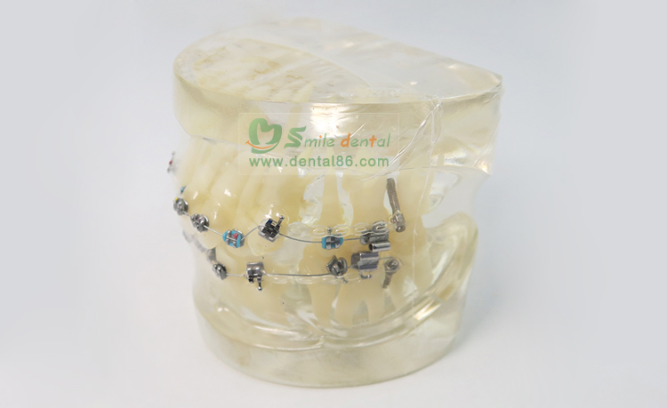 TM-B2-01 Orthodontic Model